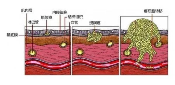 ct2nomo代表什么