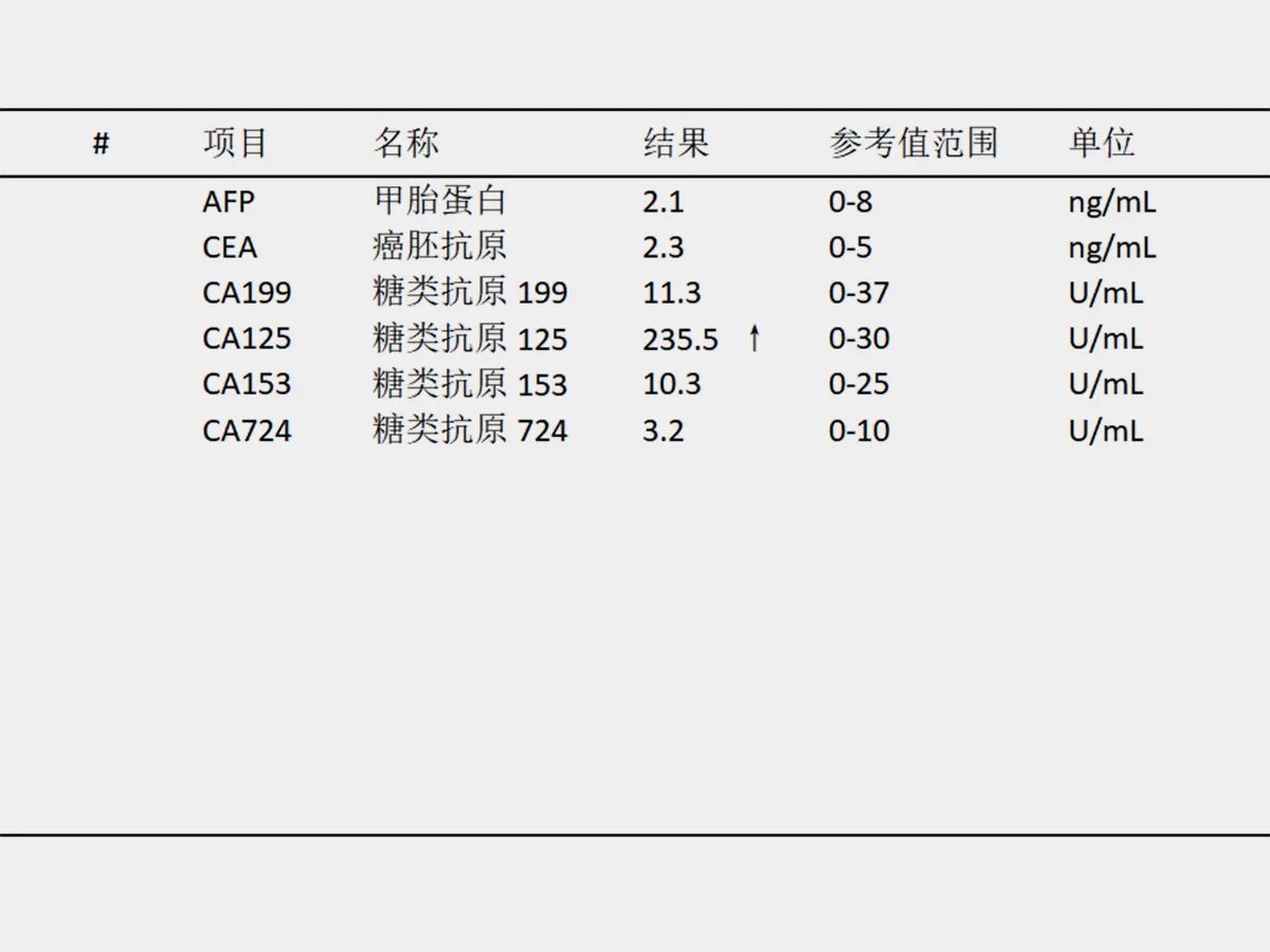 51岁阿姨确诊子宫内膜间质肉瘤,综合治疗助其控制病情