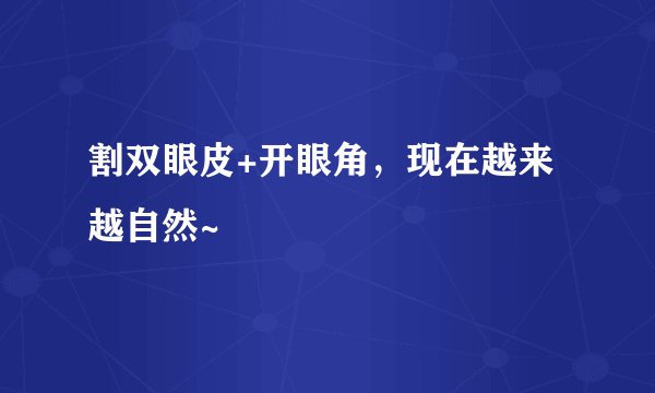 割双眼皮+开眼角，现在越来越自然~