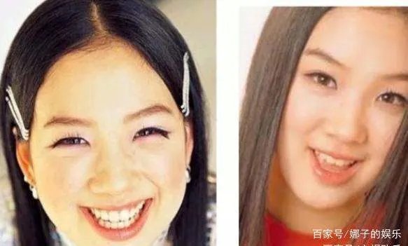 《我叫金三顺》中的微笑女王因整容变丑,如今怎样了?