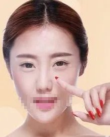 天津双眼皮修复哪些医院比较好