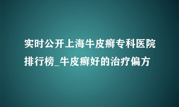实时公开上海牛皮癣专科医院排行榜_牛皮癣好的治疗偏方
