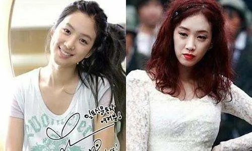 《我叫金三顺》中的微笑女王因整容变丑,如今怎样了?