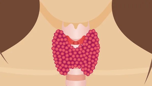 甲亢和大脖子病一样吗