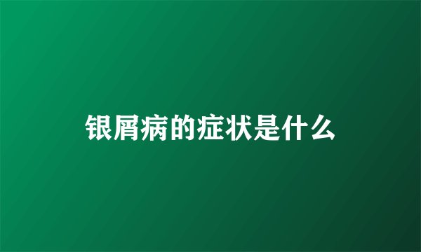 银屑病的症状是什么