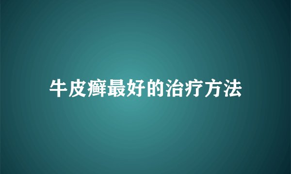 牛皮癣最好的治疗方法