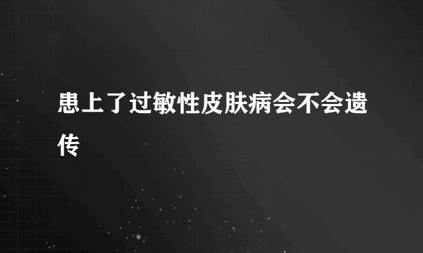 患上了过敏性皮肤病会不会遗传