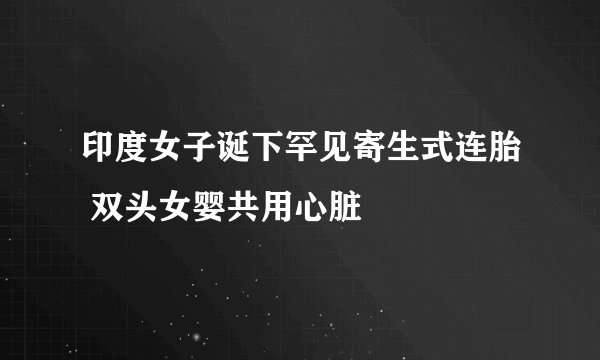印度女子诞下罕见寄生式连胎 双头女婴共用心脏