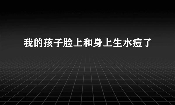 我的孩子脸上和身上生水痘了