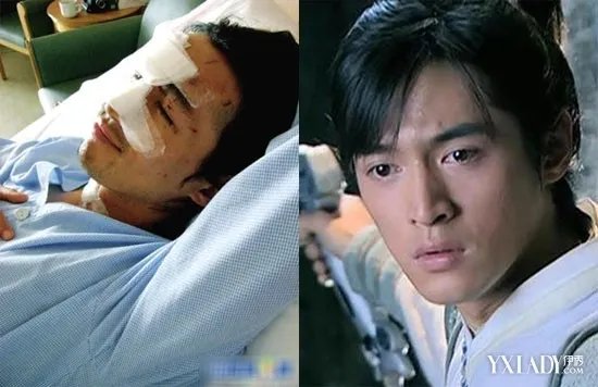 【组胡歌车祸毁容照片曝光胡歌整容前后照片萌神硬汉脸哪个更帅？