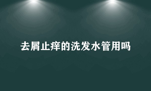 去屑止痒的洗发水管用吗