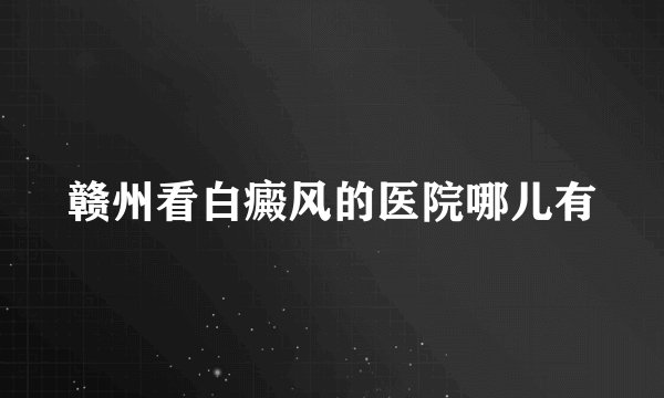 赣州看白癜风的医院哪儿有