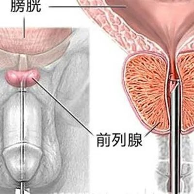 尿痛是什么原因