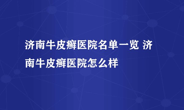 济南牛皮癣医院名单一览 济南牛皮癣医院怎么样