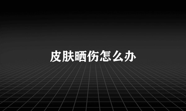 皮肤晒伤怎么办