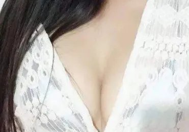 广州隆胸假体取出哪个医院好