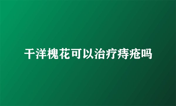 干洋槐花可以治疗痔疮吗
