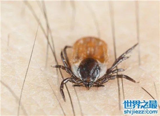 可怕!蜱虫叮咬后伤口图片竟是这样,咬伤后必须恰当处理! ...