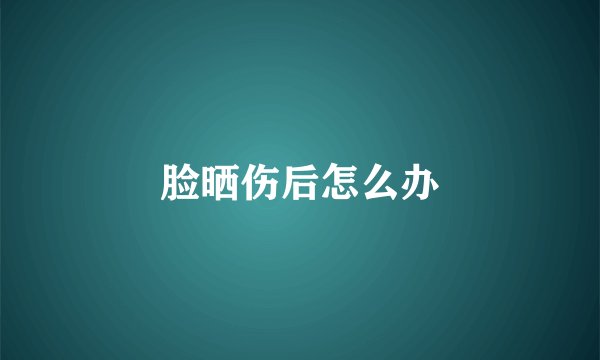 脸晒伤后怎么办
