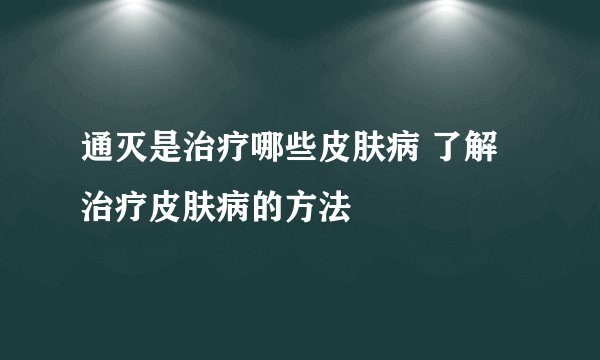 通灭是治疗哪些皮肤病 了解治疗皮肤病的方法