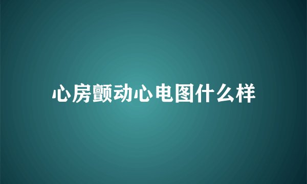 心房颤动心电图什么样