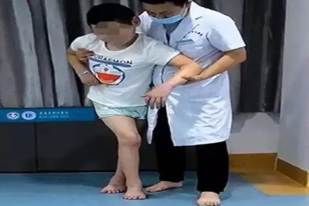 脑瘫儿脚成剪刀型图片