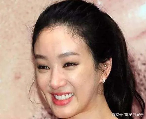 《我叫金三顺》中的微笑女王因整容变丑,如今怎样了?