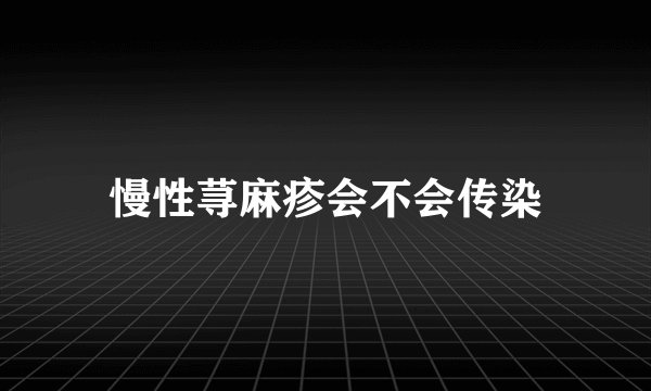 慢性荨麻疹会不会传染