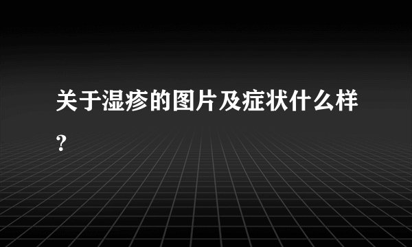 关于湿疹的图片及症状什么样？