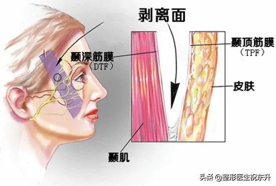 脸上皮肤松弛怎么办?