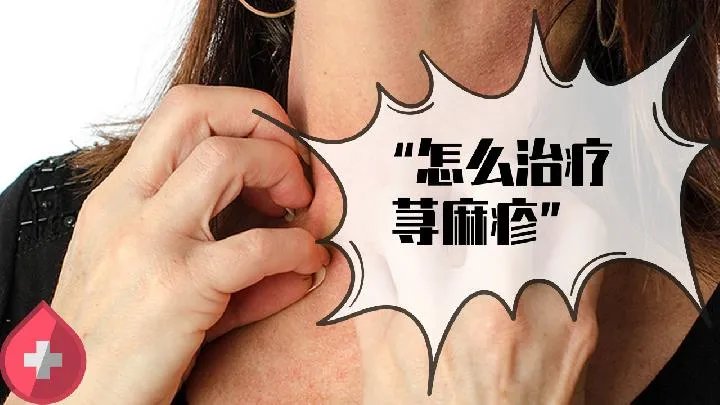 怎样更好地预防秃发性毛囊炎