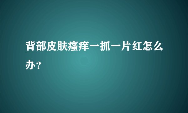 背部皮肤瘙痒一抓一片红怎么办？