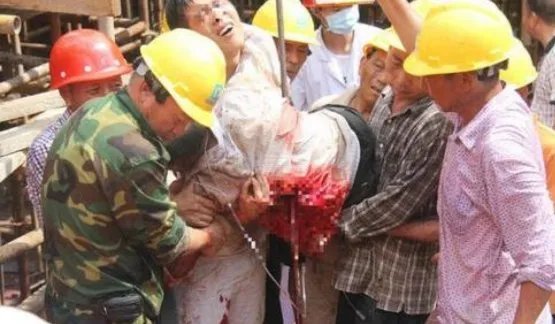 工人被四根钢筋贯穿受伤后情况如何？