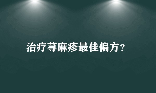 治疗荨麻疹最佳偏方？