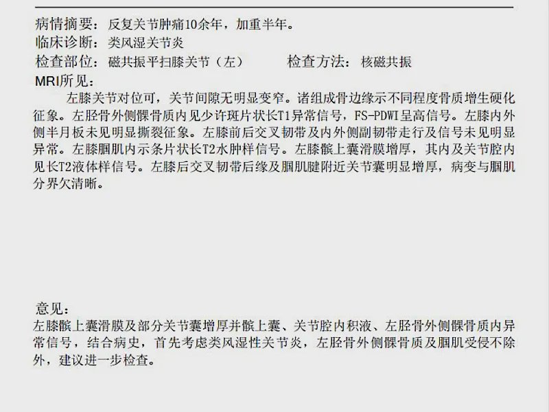 55岁阿姨反复关节疼痛10余年,小心类风湿性关节炎加重