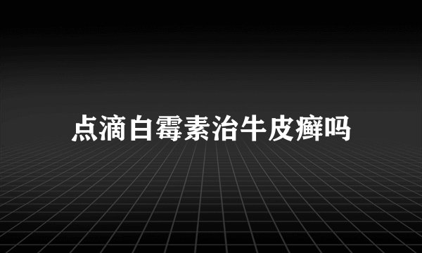 点滴白霉素治牛皮癣吗