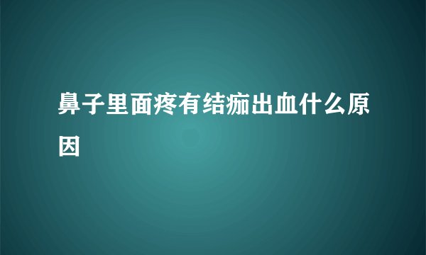 鼻子里面疼有结痂出血什么原因
