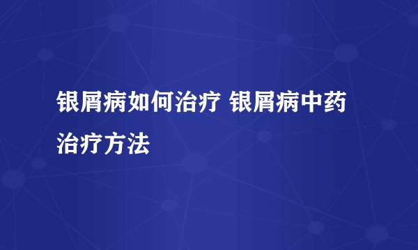 银屑病如何治疗 银屑病中药治疗方法