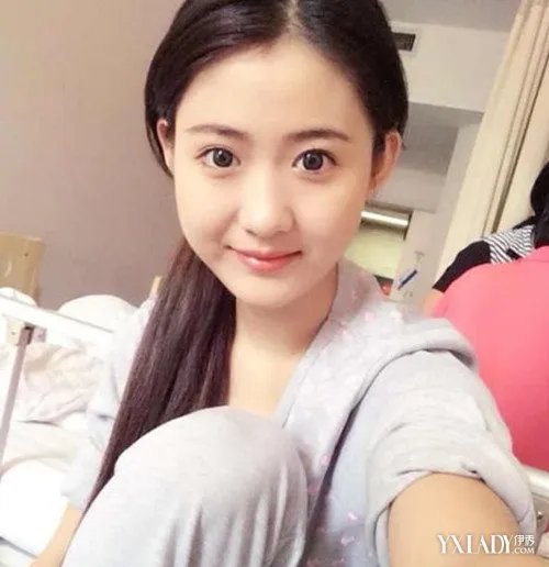 中国梦想秀李娜去世被网友誉为“最美癌症女孩”
