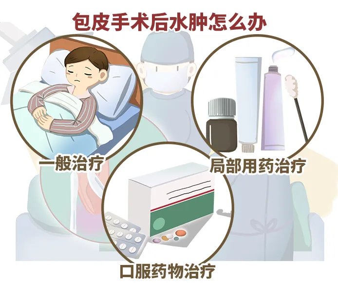 包皮手术后水肿怎么办