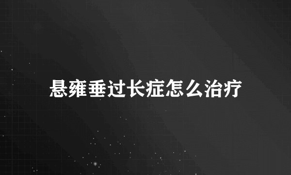 悬雍垂过长症怎么治疗