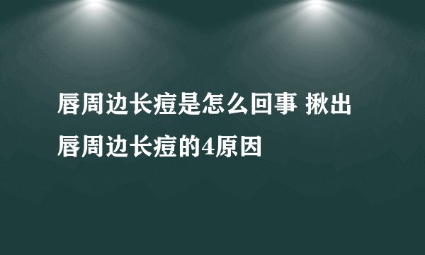 唇周边长痘是怎么回事 揪出唇周边长痘的4原因