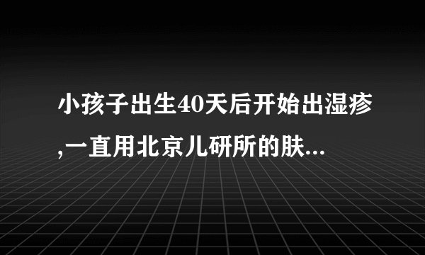 小孩子出生40天后开始出湿疹,一直用北京儿研所的肤乐霜,一抹就好,停药就又痒,一直擦药好吗.到多大就..