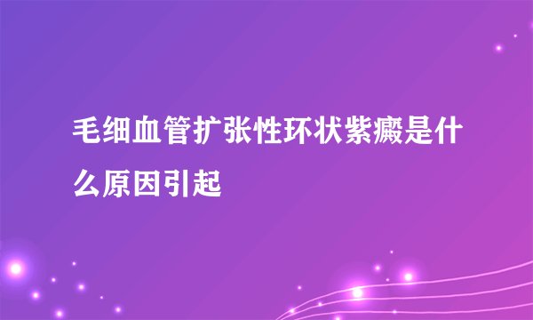 毛细血管扩张性环状紫癜是什么原因引起