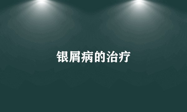 银屑病的治疗