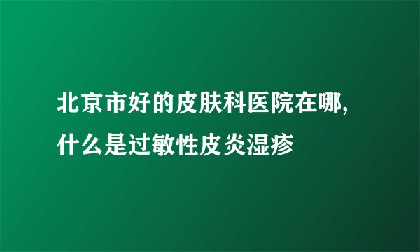 北京市好的皮肤科医院在哪,什么是过敏性皮炎湿疹