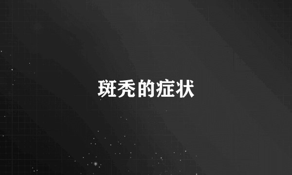 斑秃的症状