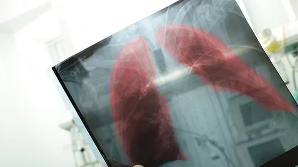 CSA联合MMF预防H-2半相鼠非清髓骨髓移植GVHD研究