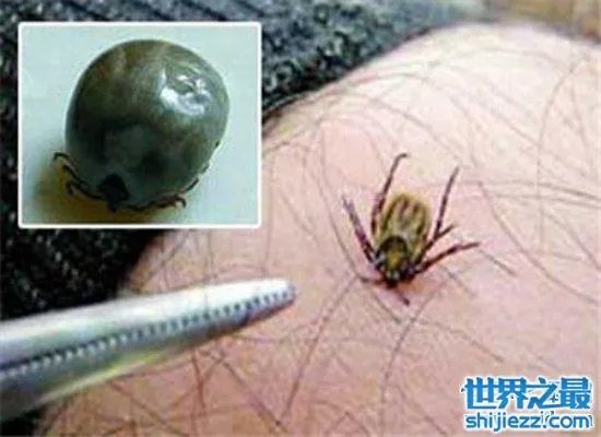 可怕!蜱虫叮咬后伤口图片竟是这样,咬伤后必须恰当处理! ...