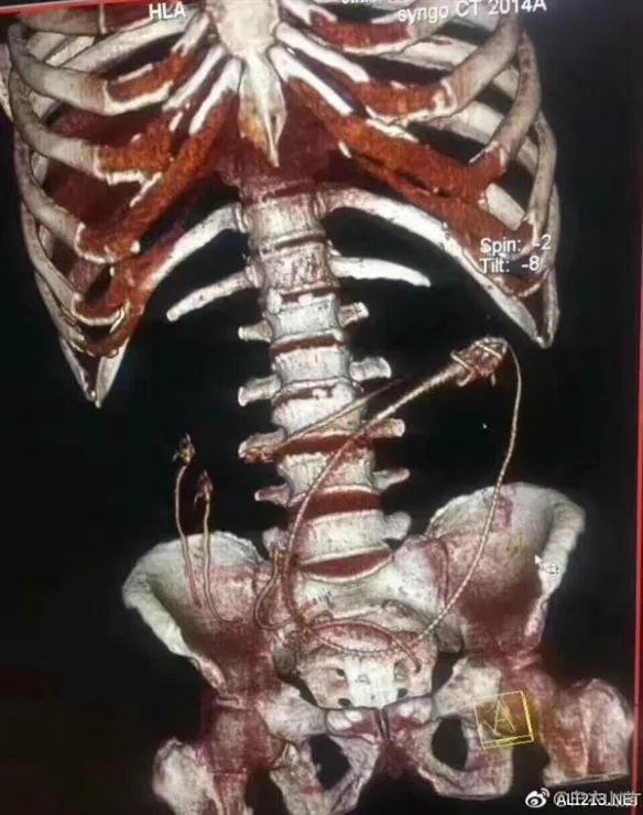 女主播用黄鳝进行了不可描述事情 最终竟然玩脱!